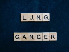 Inherited EGFR Mutation May Change How Lung-Cancer Risk Is Assessed Scrabble tiles spelling lung cancer on dark background symbolizing awareness.